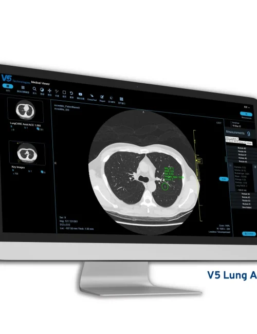 Product-picture_1_Lung-AI