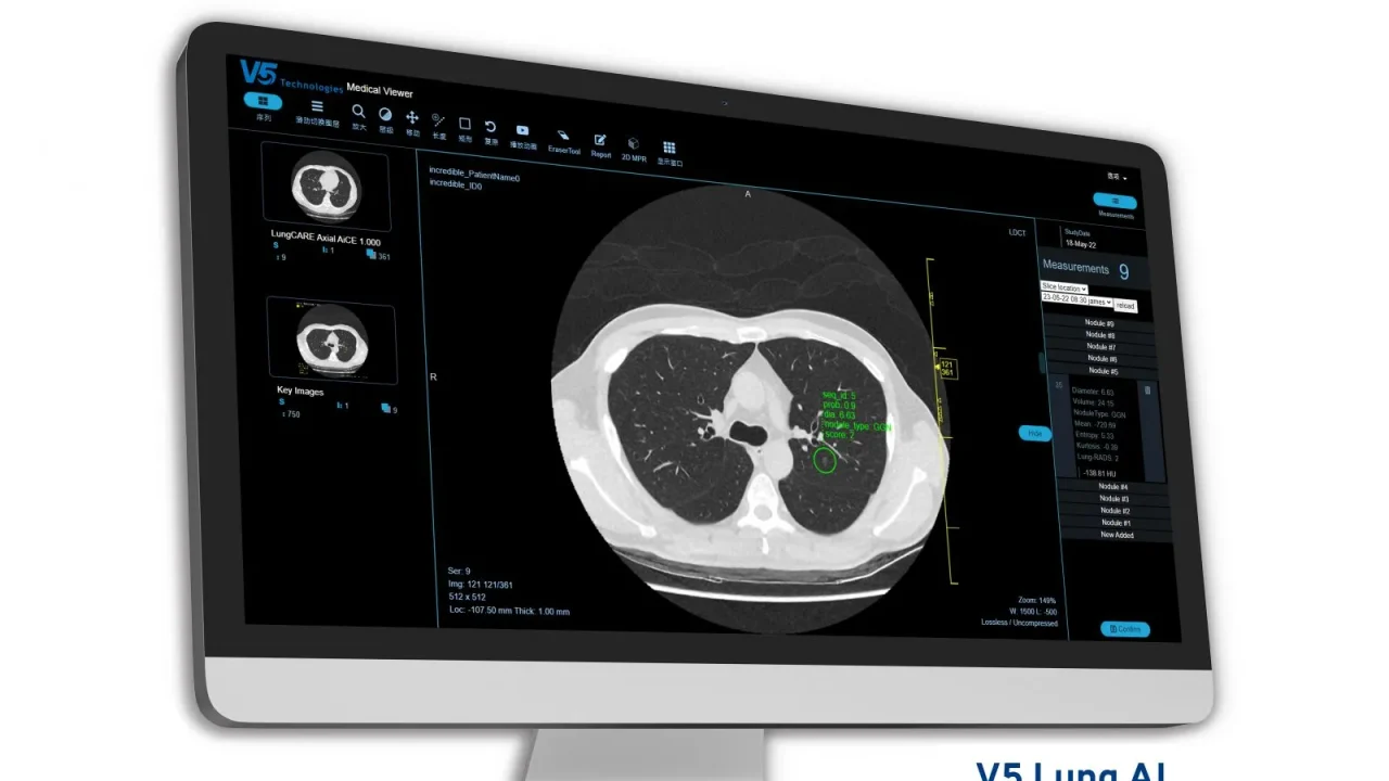 Product-picture_1_Lung-AI