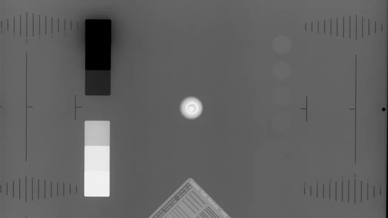 RAD-Digi-X-ray-image-Rad70kV5mAs